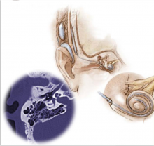Otorinolaringoiatria 