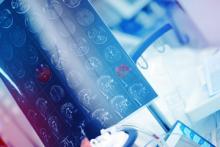 Diagnostica per Immagini e Radioterapia      